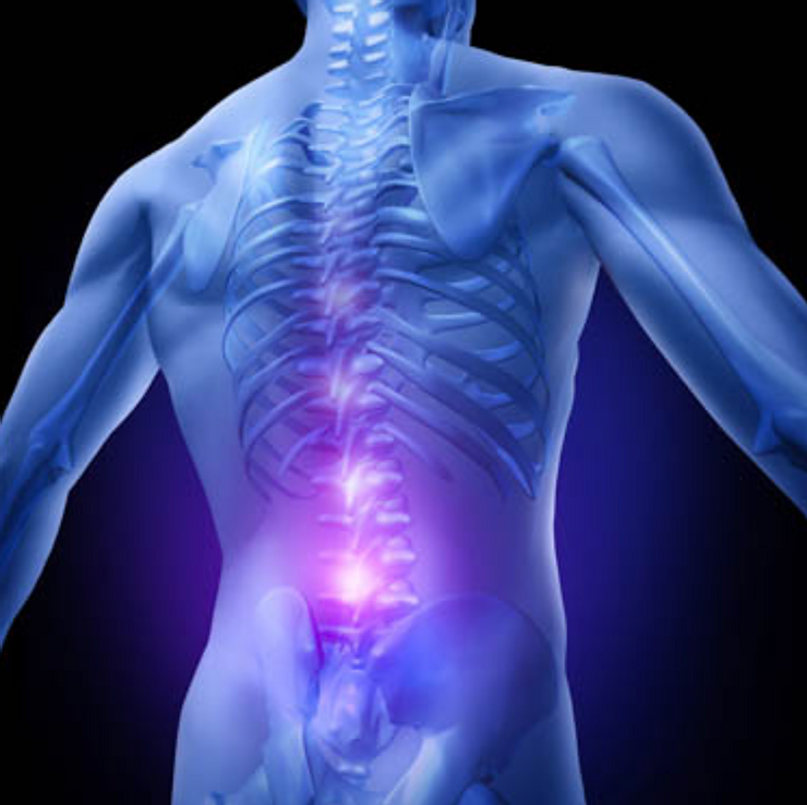 Image of mans skeleton showing back pain points